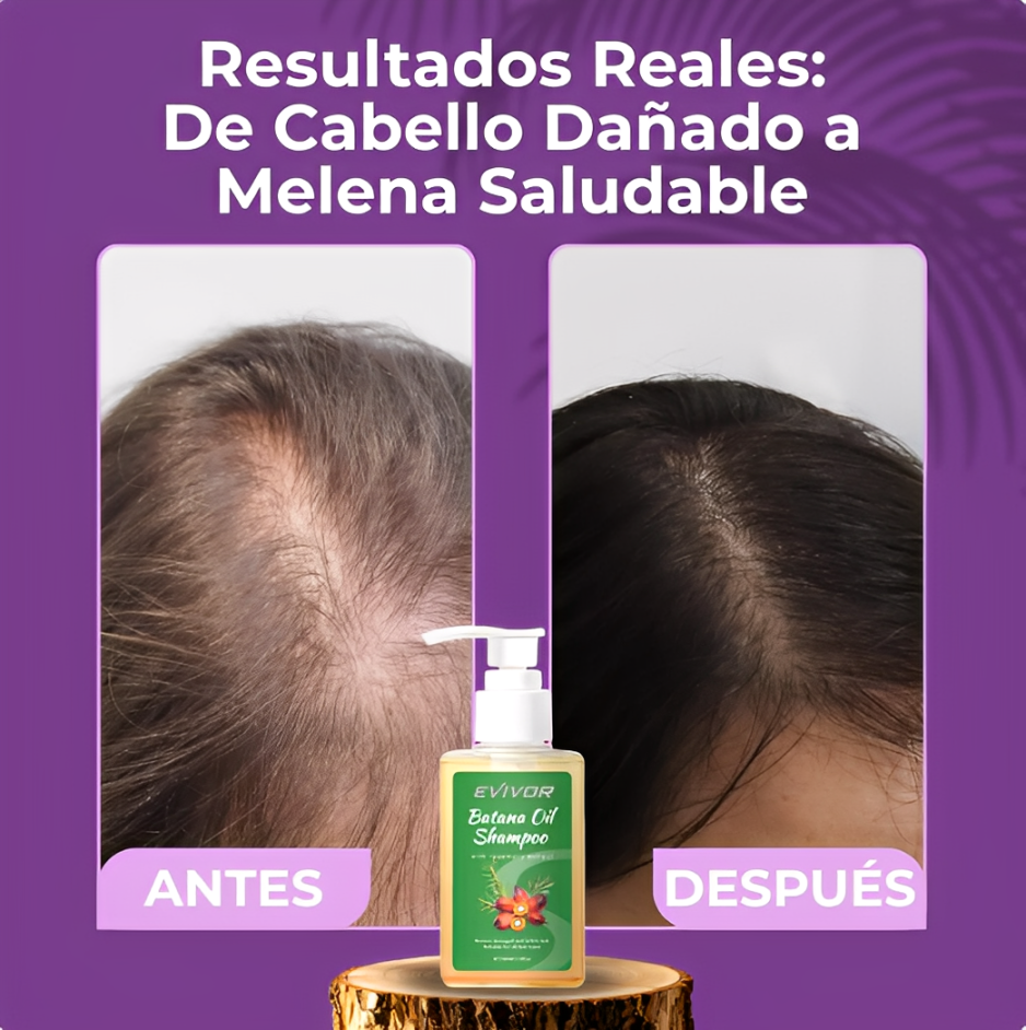 Shampoo BatanaPro™ La Fuerza que Tu Cabello Necesita